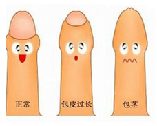 苏州市包皮医院
